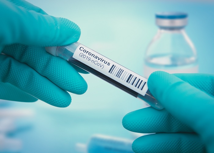 UK’s Urgent Call for COVID-19 Testing for Pharmacy Staff.