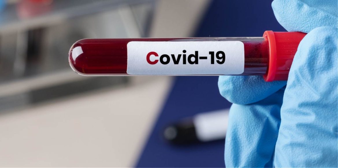Το Φαινόμενο Επαναμόλυνσης COVID-19 Εγείρει Ζητήματα για τη Δυνατότητα Κυκλοφορίας του Ιού στην Κοινότητα και τον Εμβολιασμό.
