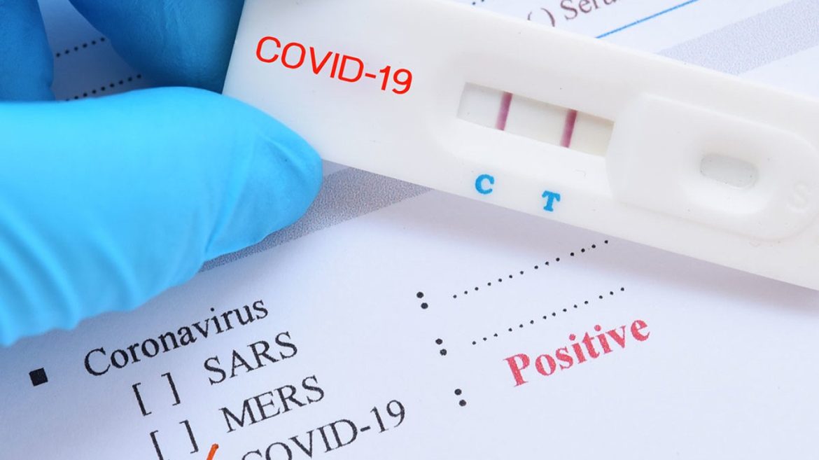 Οι Προκλήσεις της Ευρείας Χρήσης των Rapid Tests για τον Περιορισμό της Εξάπλωσης του SARS-CoV-2.