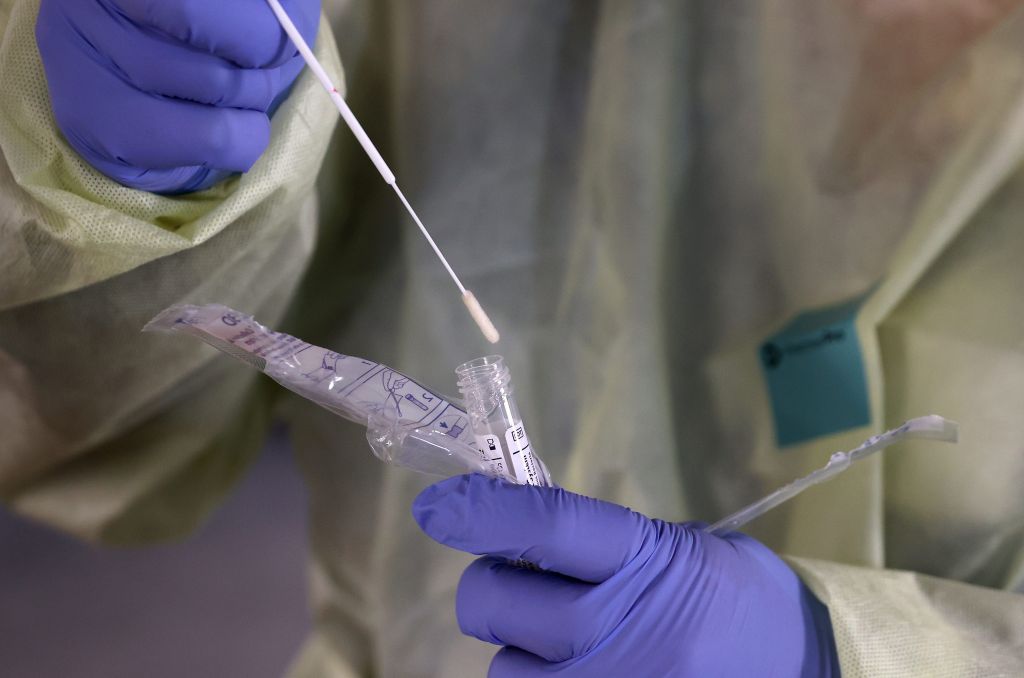 Η ευρεία χρήση των τεστ απαιτεί ευρεία αποδοχή των διαδικασιών δοκιμής. Η ευρεία χρήση των τεστ απαιτεί ευρεία αποδοχή των διαδικασιών δοκιμής.