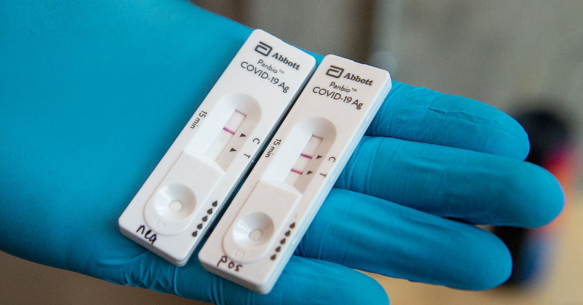 Διενέργεια των Rapid Tests Μόνο από Γιατρούς Ζητούν οι Ιατρικοί Σύλλογοι ΑΜΘ Διενέργεια των Rapid Tests Μόνο από Γιατρούς Ζητούν οι Ιατρικοί Σύλλογοι ΑΜΘ